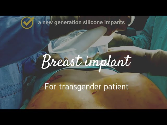 A new generation silicone breast Implant in Transgender patient