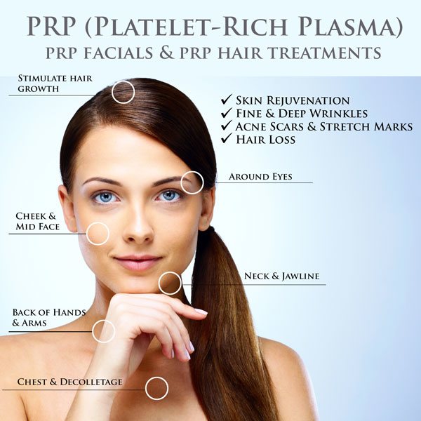 PRP Treatment
