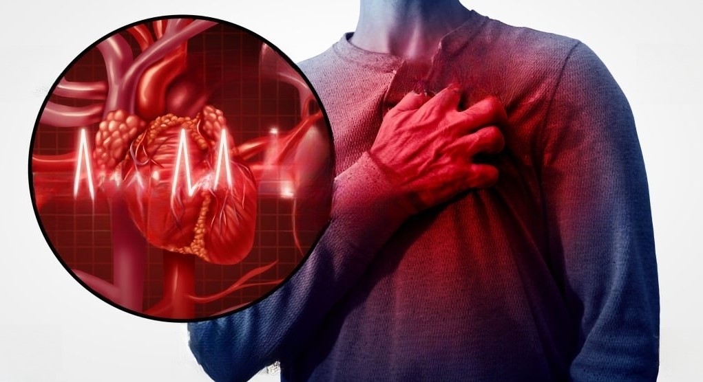 Hypertension & Heart Disease Treatment