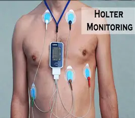 Holter Monitoring