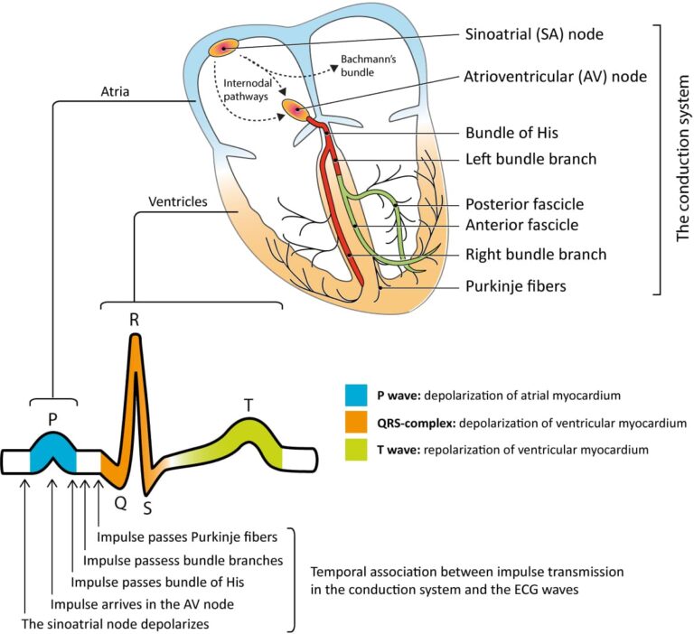 ECG (Electrocardiogram)