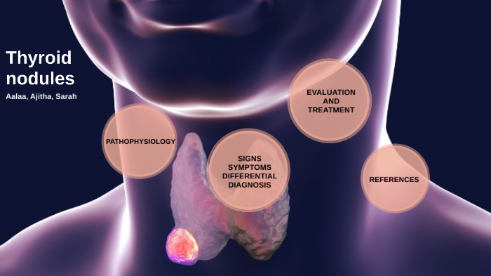 Thyroid illness