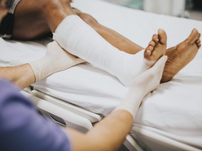 Fracture Treatment Orthopedic Specialist
