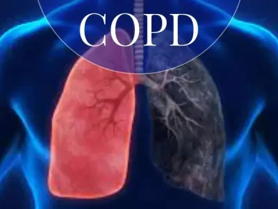 Asthma & COPD Management