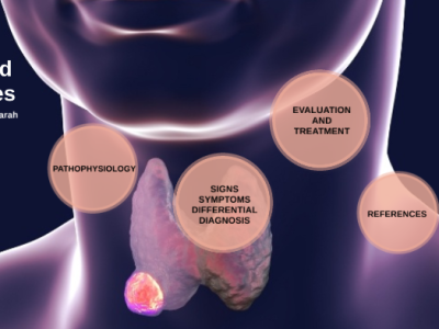 Thyroid illness