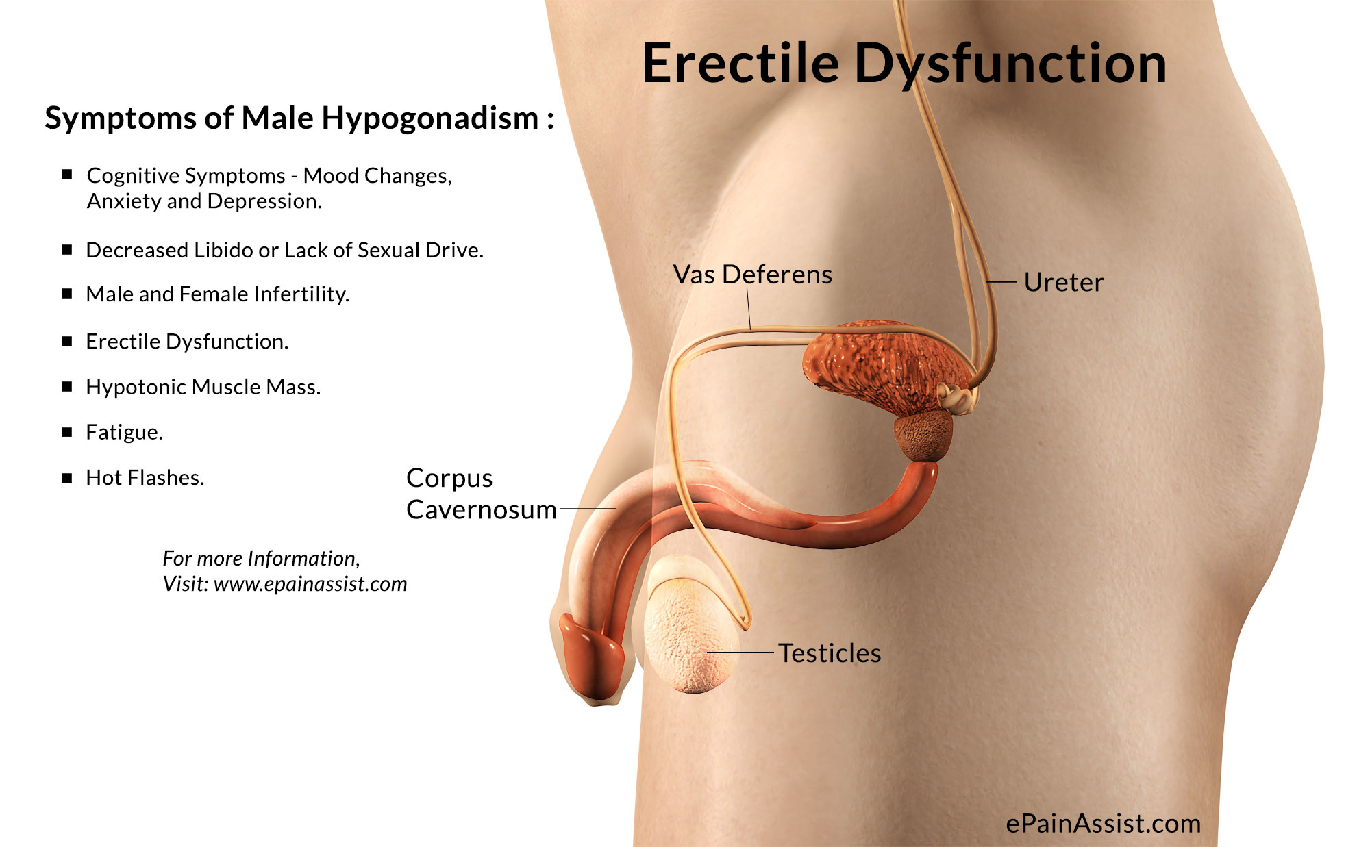 Erectile Dysfunction