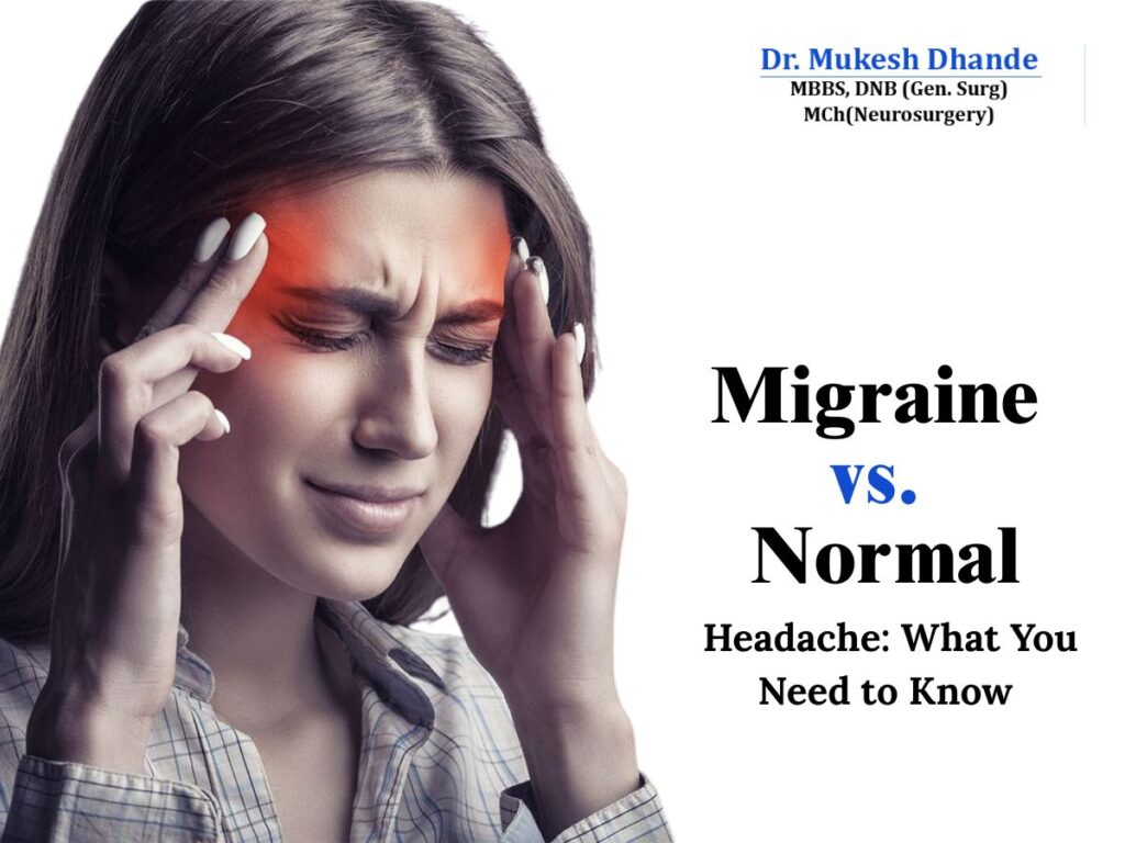 Migraine vs. Normal Headache: What You Need to Know